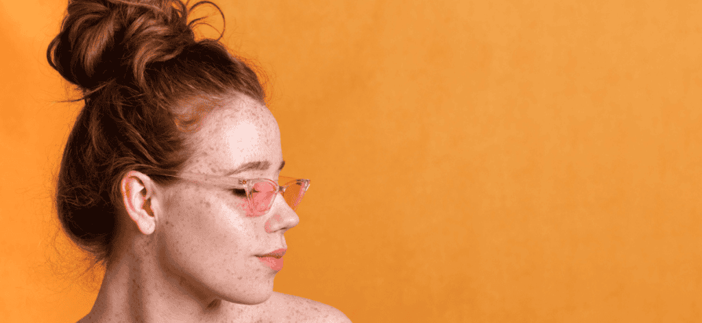 Malassezia gomba: A hajhagyma rejtélyes védőpajzsa a korpásodás ellen