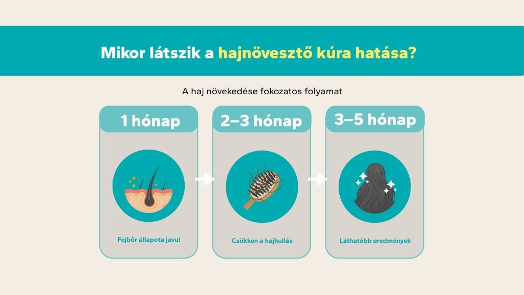 hajnövesztő kúra hatása mikor látszik idővonal 1 hónap 3 hónap 5 hónap hajhullás csökkenése